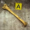 Tibia bone